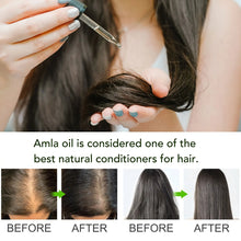 Load image into Gallery viewer, Aliver Amla Hair &amp; Scalp Oil 100% Pure Cold-Pressed Amla Oil for Hair Growth
