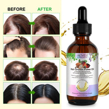 Load image into Gallery viewer, Hair Growth Power Mix Oil Aliver 100% Pure Natural Fast Thrive Hair Growth Hair Loss Treatment For Women And Men
